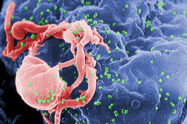 Virus HIV nhìn qua kính hiển vi. (Nguồn: ANSA)