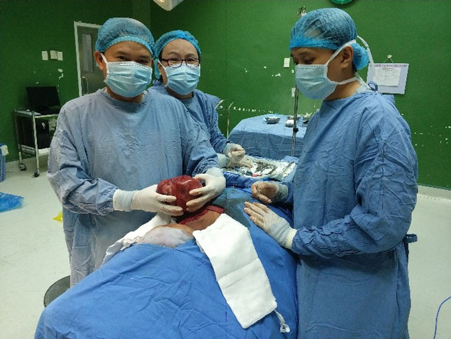 Một khối u bướu của bệnh nhân nặng 2kg từng được các bác sĩ khoa Ngoại lồng ngực Bệnh viện Đà Nẵng phẫu thuật. (Ảnh do khoa Ngoại lồng ngực cung cấp)