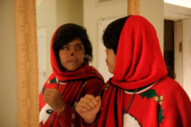 Một phụ nữ Afghanistan đang soi gương khuôn mặt của mình bị biến dạng vì bạo lực.