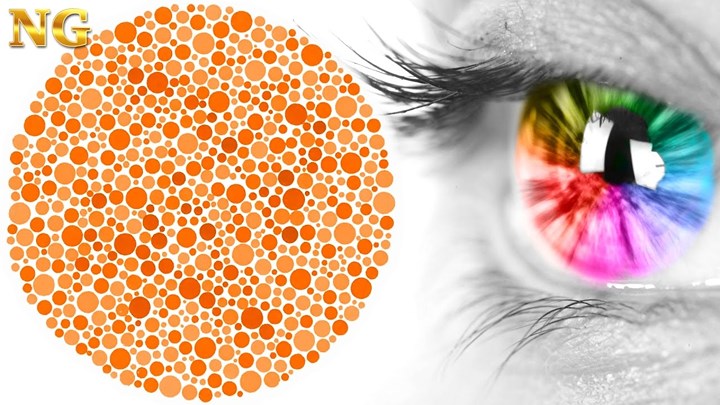 Bệnh mù màu: Bệnh rối loạn sắc giác hay loạn sắc giác thường được gọi là bệnh mù màu. Đây là căn bệnh có nguyên nhân chủ yếu là di truyền. Bệnh nhân không thể phân biệt được màu sắc, có thể là không phân biệt được màu đỏ, xanh hoặc không biệt được tất cả màu sắc.
