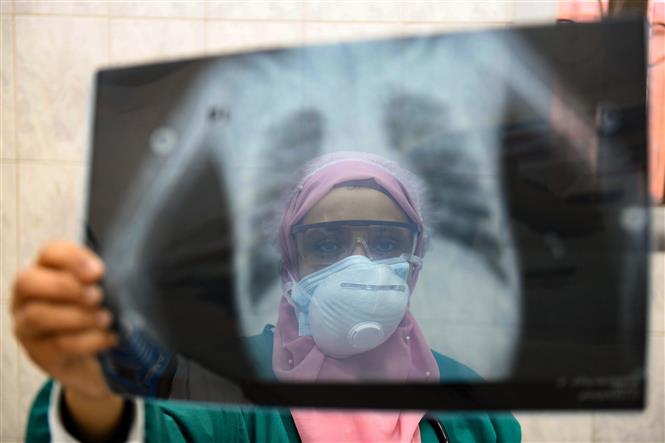 Kiểm tra hình ảnh phổi của bệnh nhân COVID-19 tại Cairo, Ai Cập. AFP/TTXVN