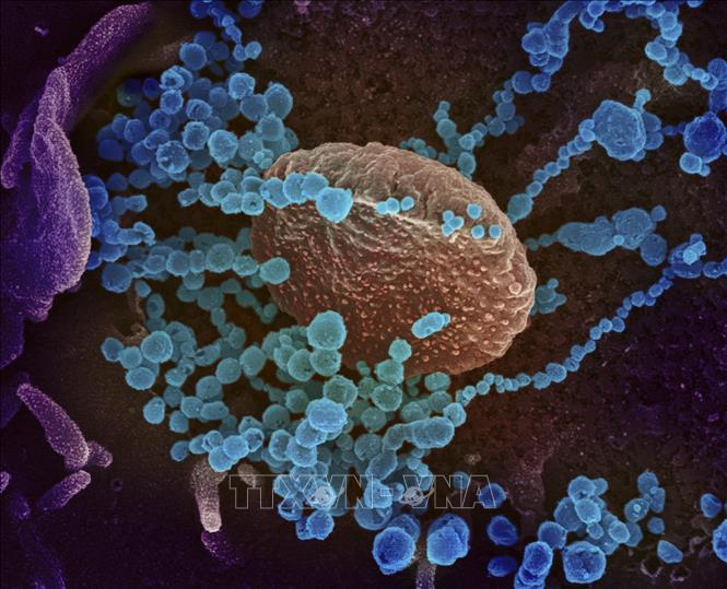 Virus SARS-CoV-2 (màu xanh) trên bề mặt các tế bào lấy từ mẫu bệnh phẩm của một bệnh nhân nhiễm COVID-2 tại Mỹ, ngày 27/2/2020. Ảnh: AFP/TTXVN